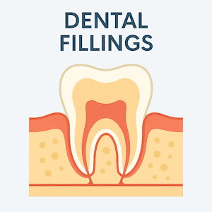 White Fillings in Guelph White Fillings in Guelph