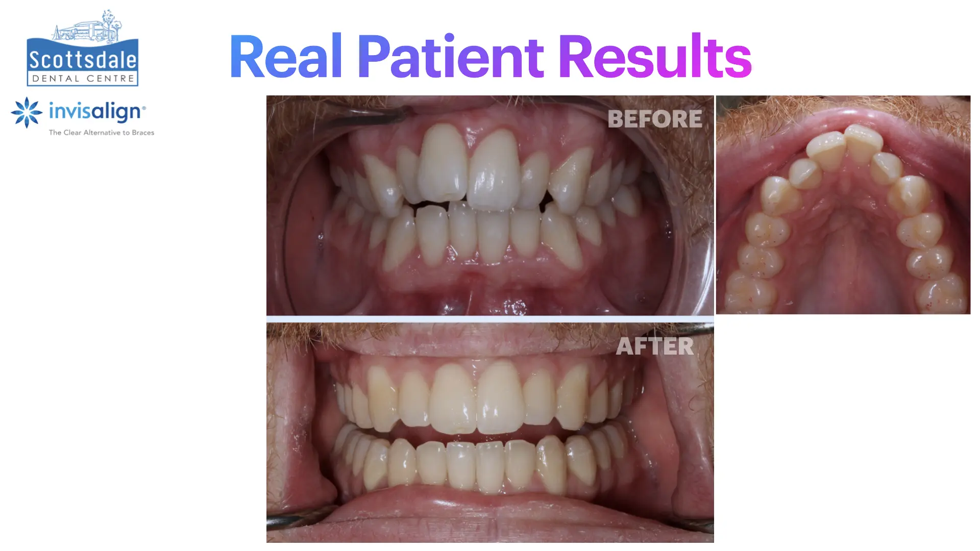 Smile Makeovers Before & After | Scottsdale Dental Centre - Guelph Family Dental Clinic