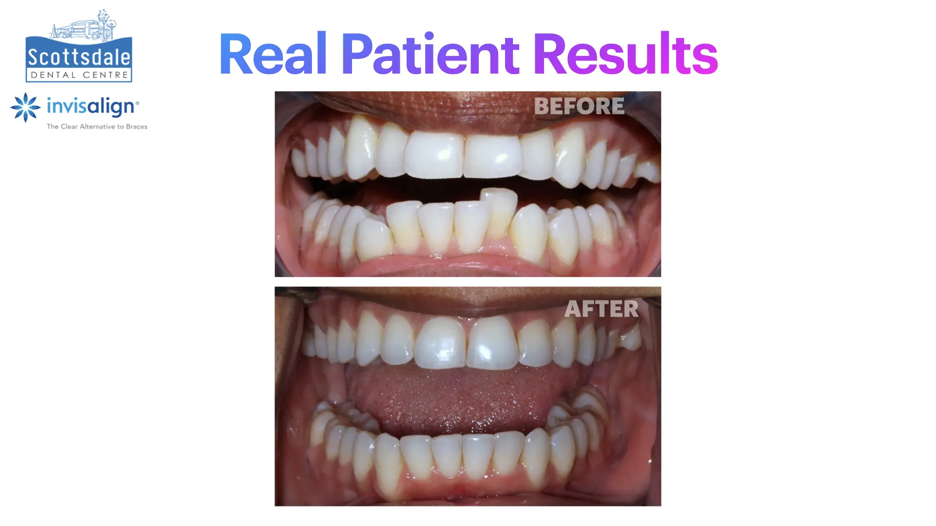 Smile Makeovers Before & After | Scottsdale Dental Centre - Guelph Family Dental Clinic