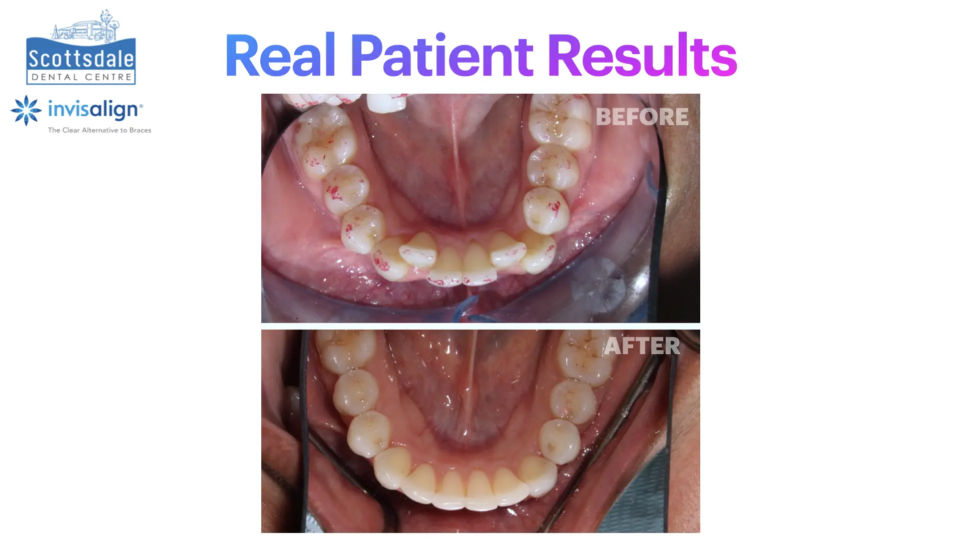 Smile Makeovers Before & After | Scottsdale Dental Centre - Guelph Family Dental Clinic