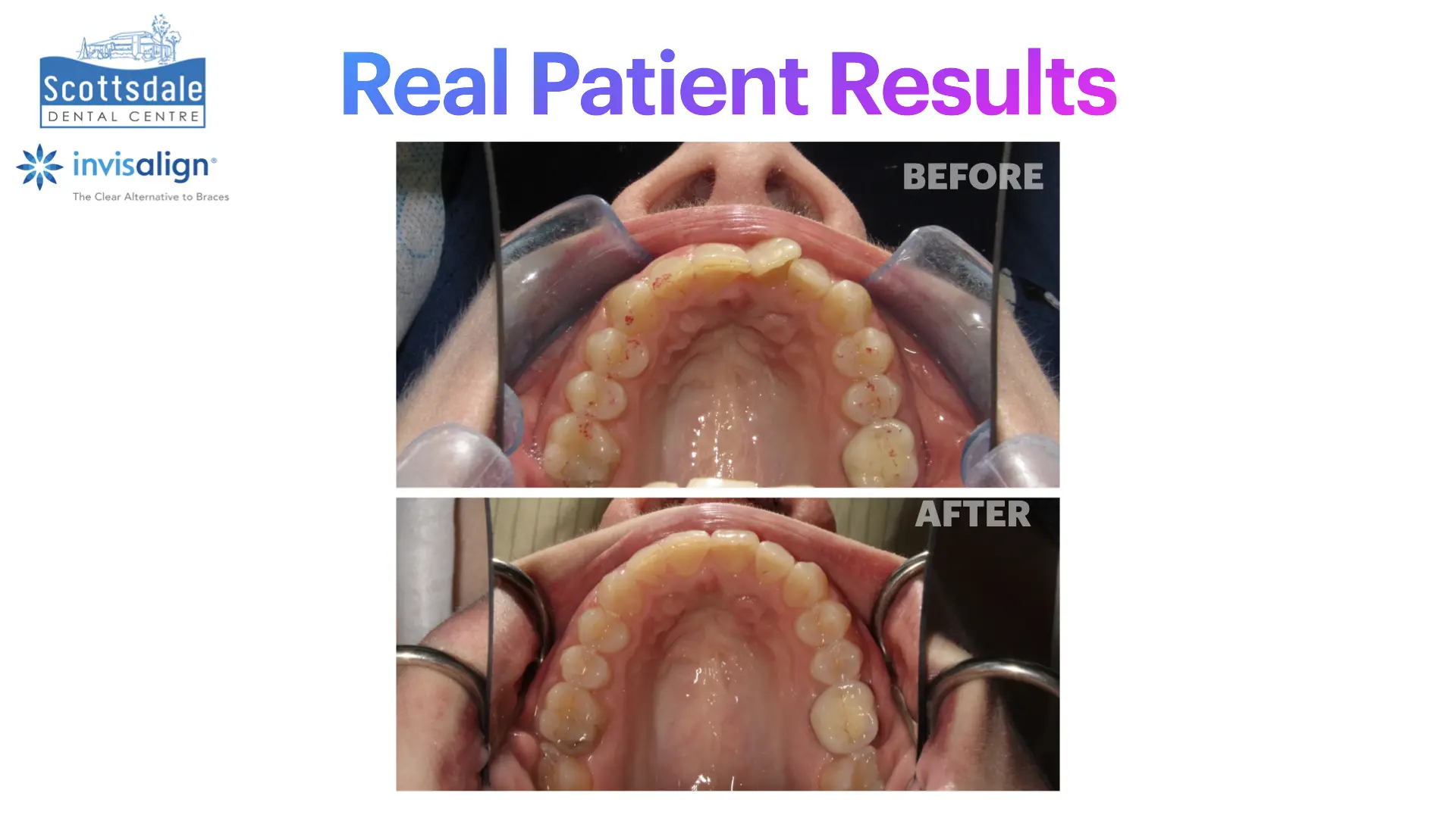Smile Makeovers Before & After | Scottsdale Dental Centre - Guelph Family Dental Clinic