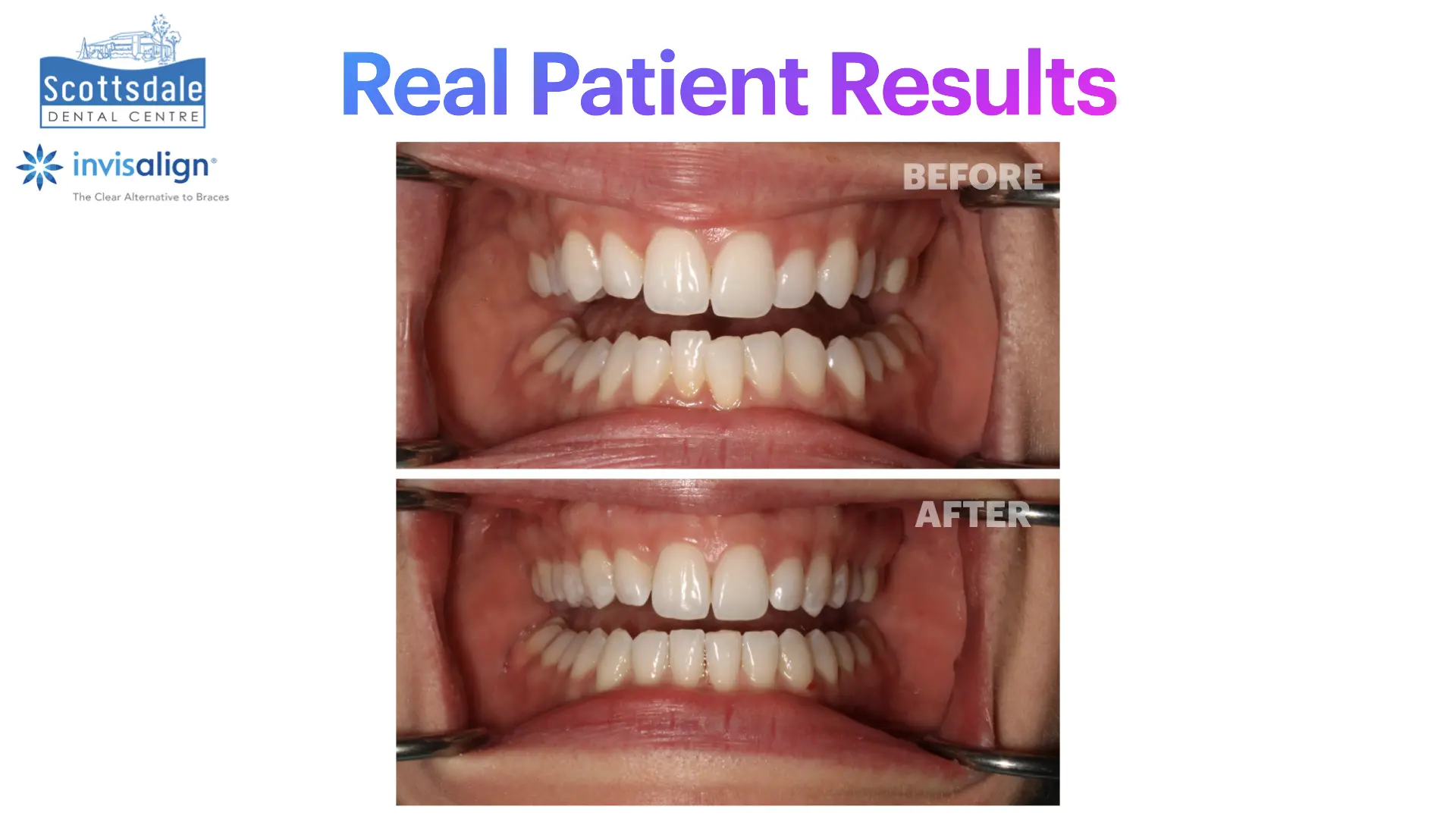 Smile Makeovers Before & After | Scottsdale Dental Centre - Guelph Family Dental Clinic