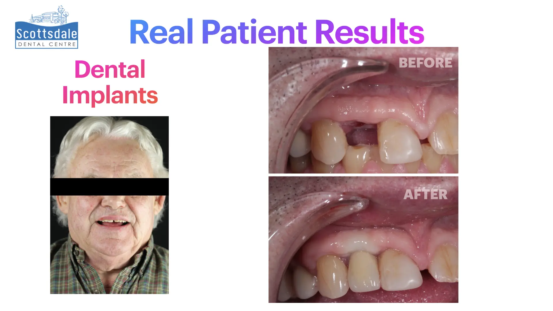 Smile Makeovers Before & After | Scottsdale Dental Centre - Guelph Family Dental Clinic