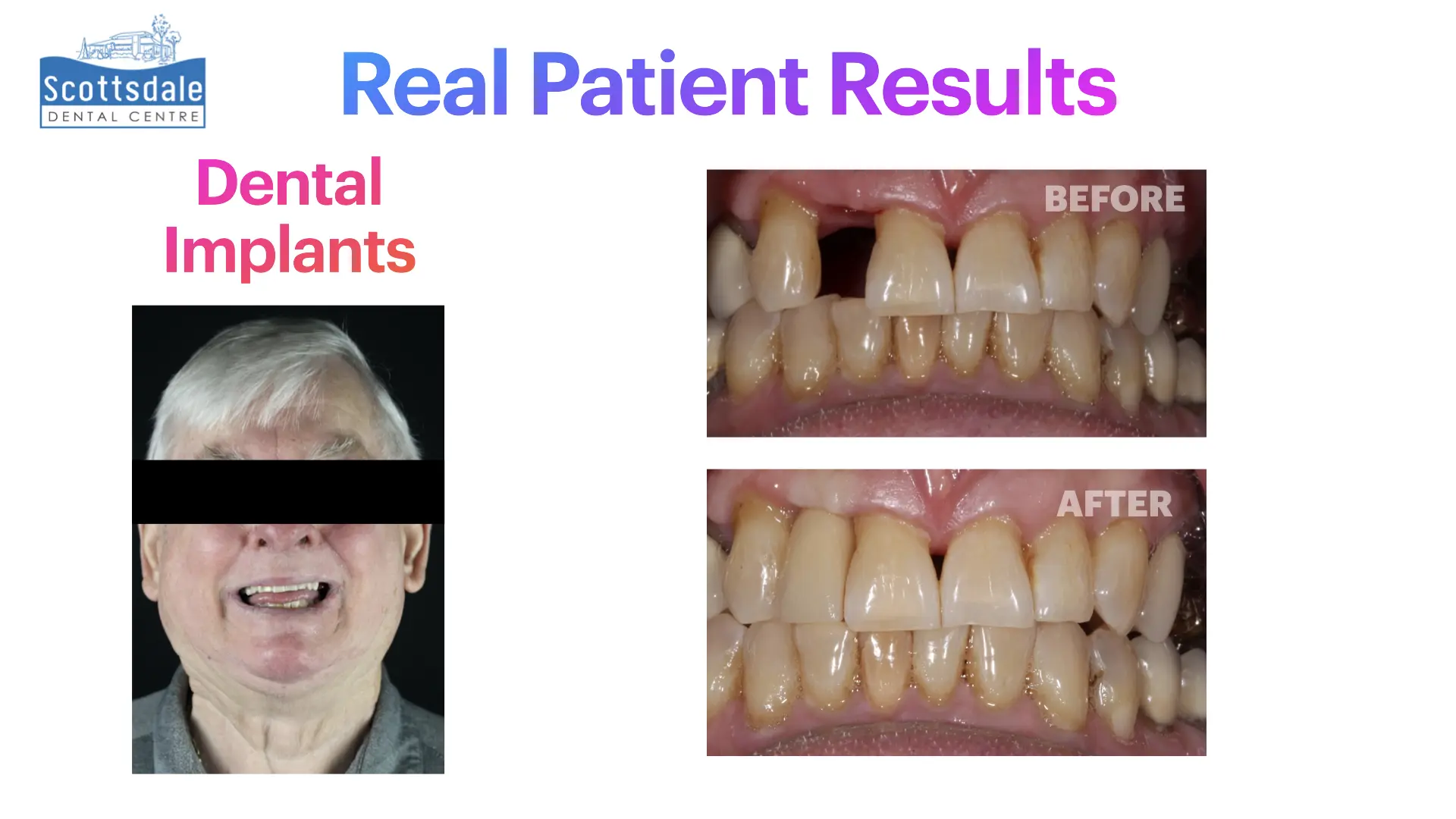 Smile Makeovers Before & After | Scottsdale Dental Centre - Guelph Family Dental Clinic