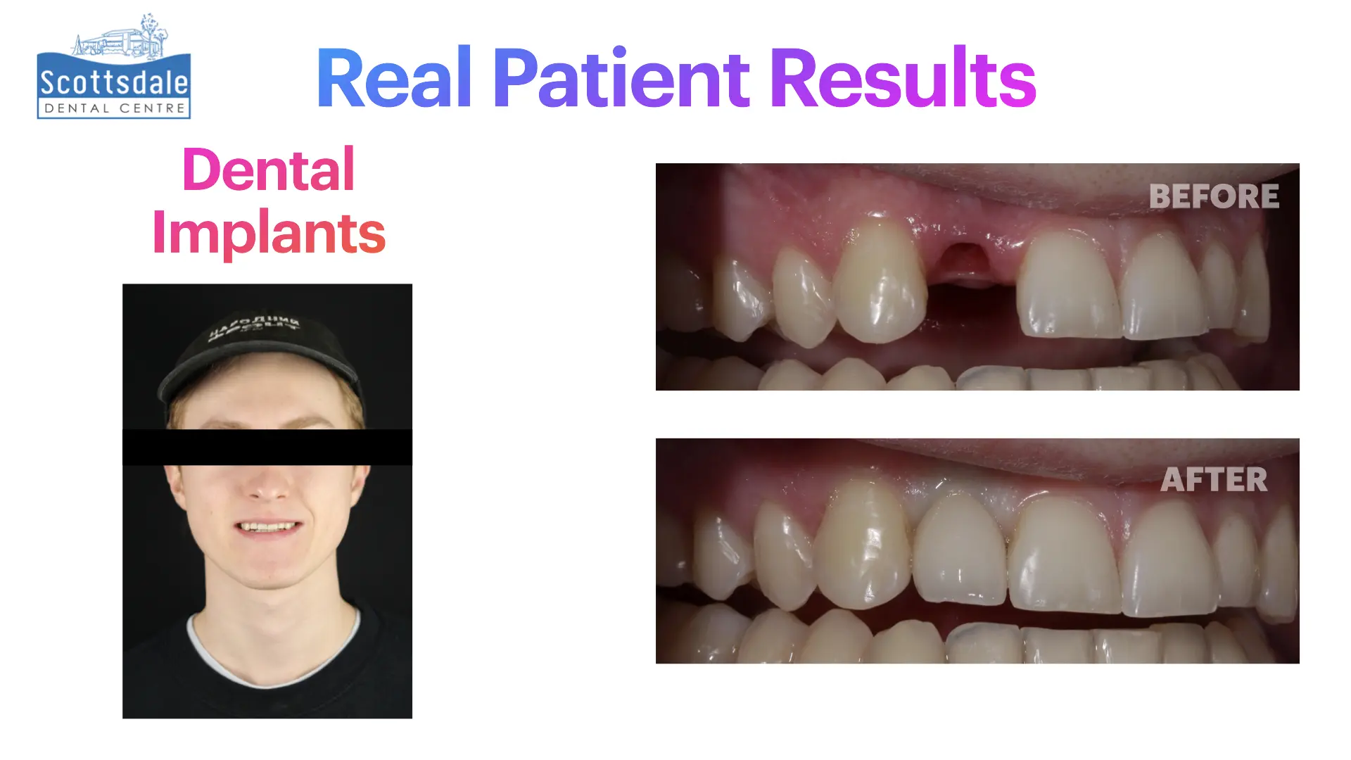 Smile Makeovers Before & After | Scottsdale Dental Centre - Guelph Family Dental Clinic