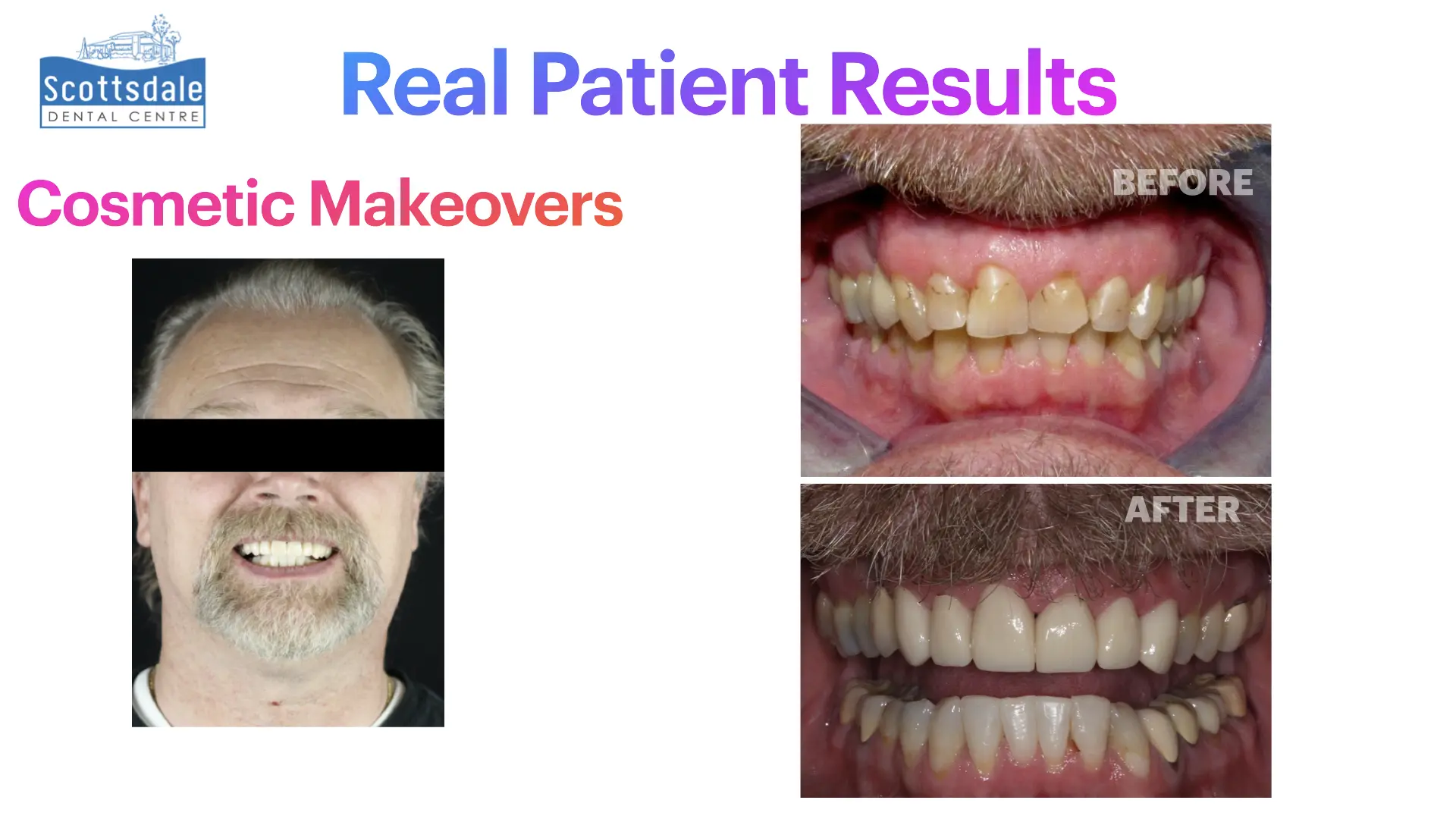Smile Makeovers Before & After | Scottsdale Dental Centre - Guelph Family Dental Clinic