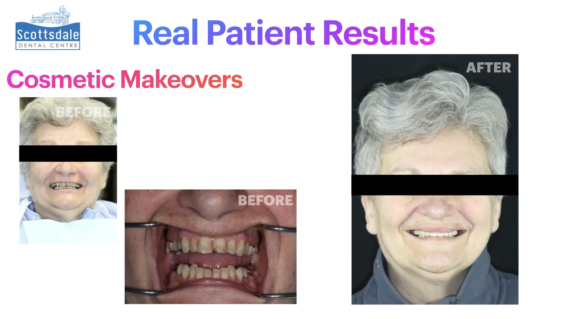 Smile Makeovers Before & After | Scottsdale Dental Centre - Guelph Family Dental Clinic