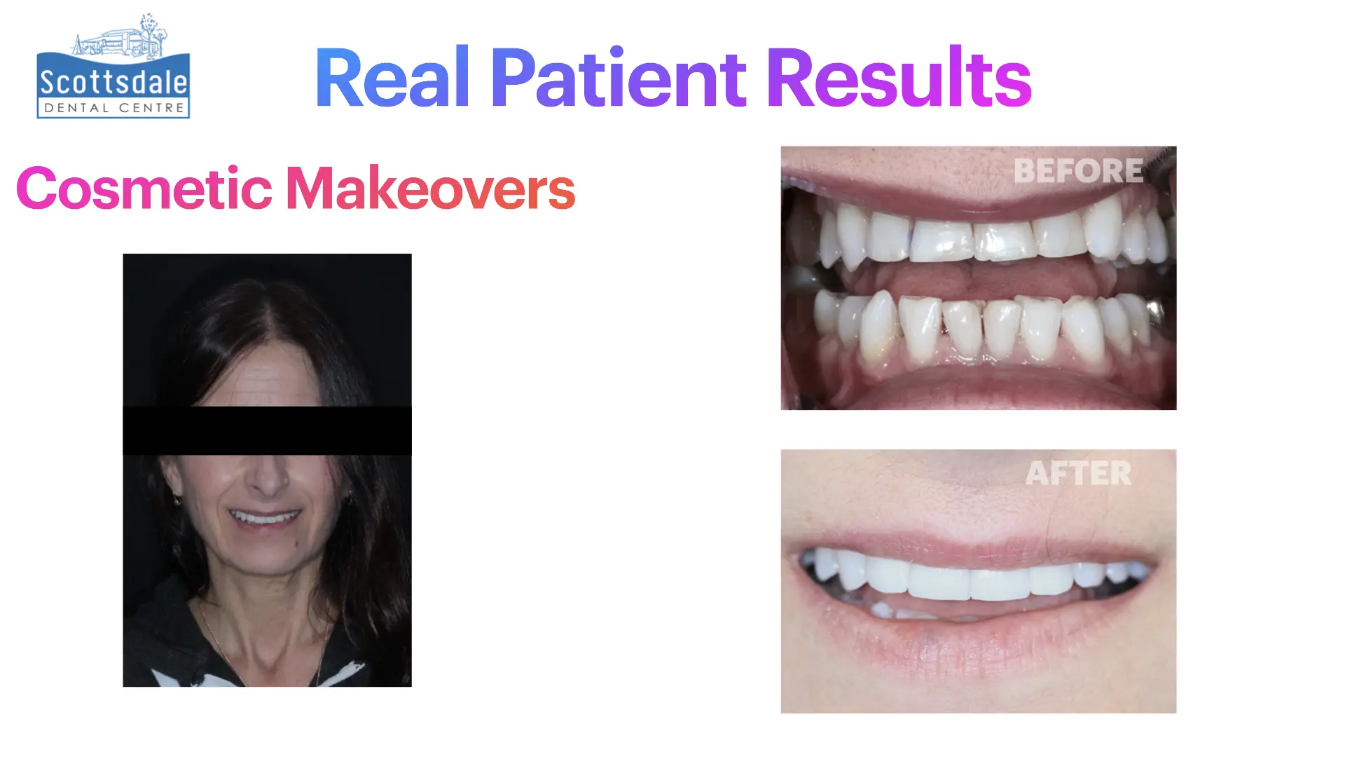 Smile Makeovers Before & After | Scottsdale Dental Centre - Guelph Family Dental Clinic