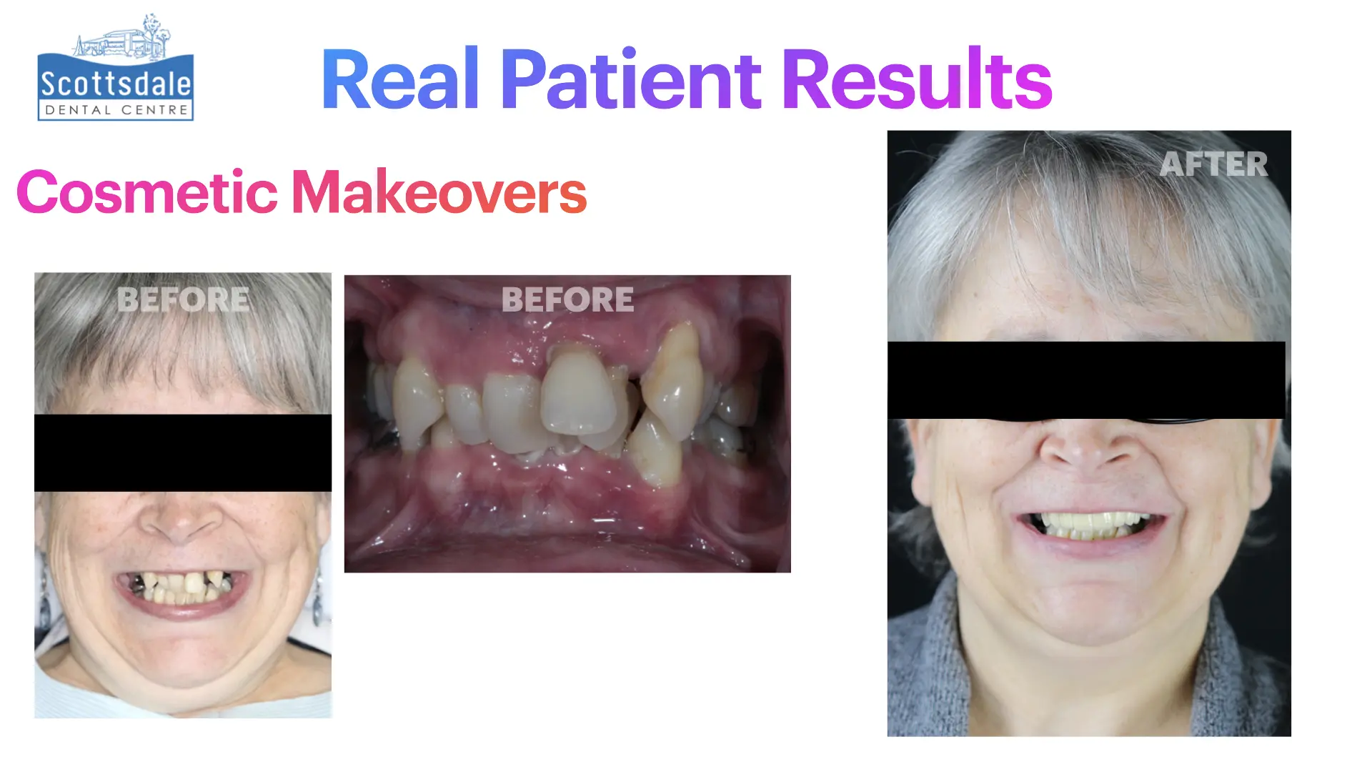 Smile Makeovers Before & After | Scottsdale Dental Centre - Guelph Family Dental Clinic