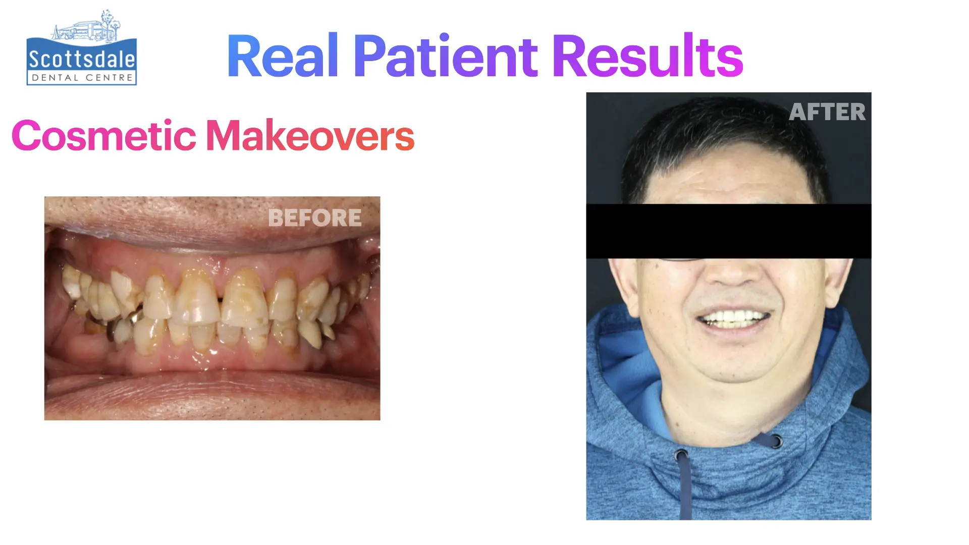 Smile Makeovers Before & After | Scottsdale Dental Centre - Guelph Family Dental Clinic