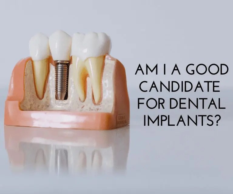 Am I a Candidate for Dental Implants? 5 Dentist Guelph Am-I-A-Good-Candidate-For-Dental-Implants-Guelph