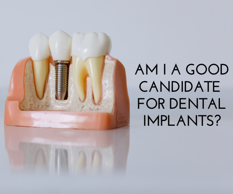 Am I a Candidate for Dental Implants? 1 Dentist Guelph Am-I-A-Good-Candidate-For-Dental-Implants-Guelph