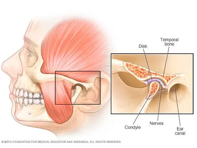 TMJ Treatment in Guelph ON