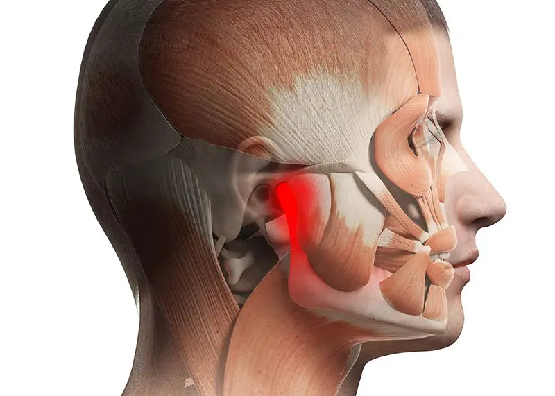TMJ Guelph 1 Dentist Guelph tmj guelph