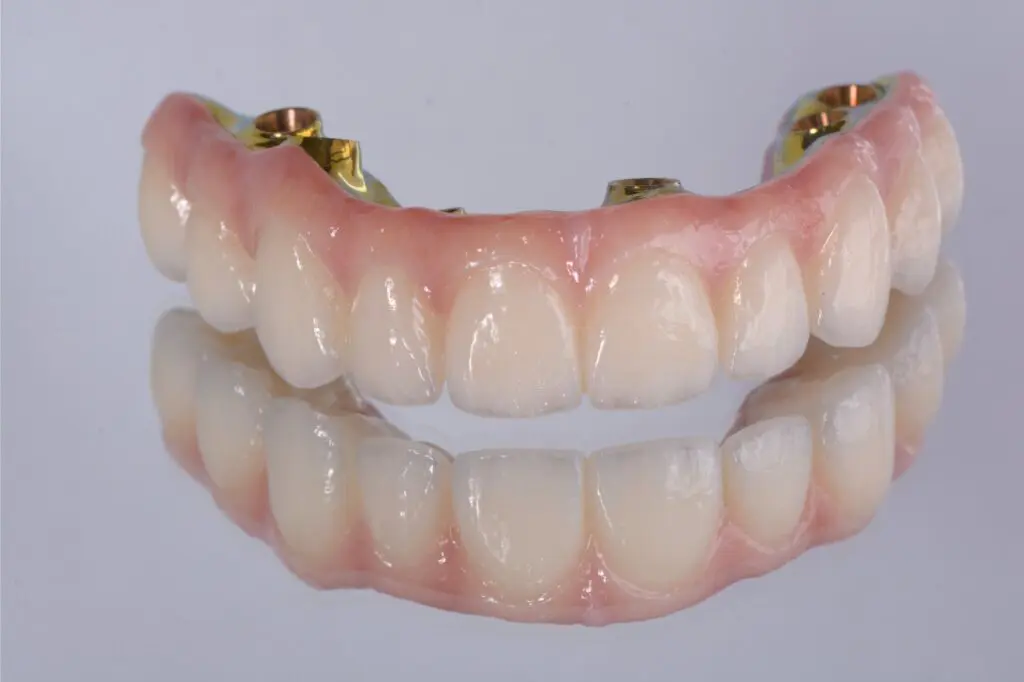 All On 4 Dental Implants Guelph