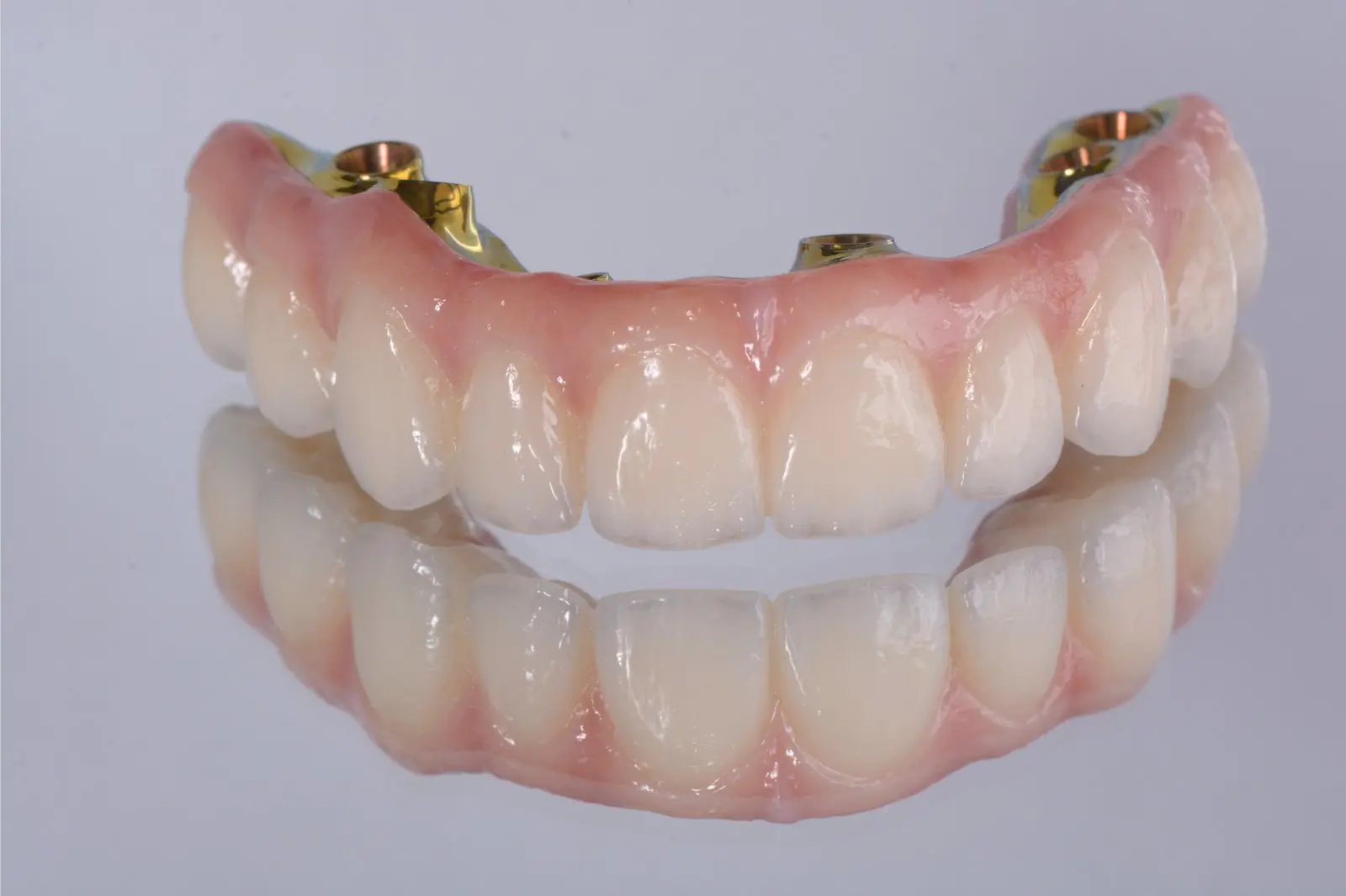 All On X Dental Implants Guelph
