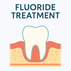 Flouride Treatment
