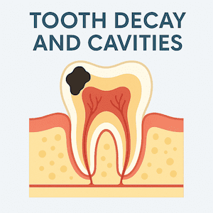 Cavities and Fillings in Guelph