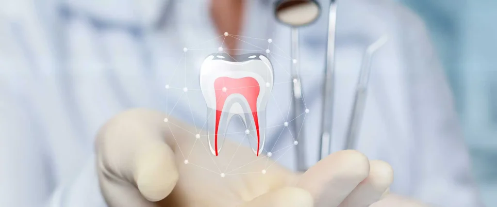 Root Canals in Guelph